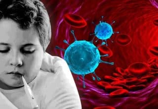 İnfluenza nedir ve belirtileri nelerdir? İnfluenza nasıl tedavi edilir? İnfluenza teşhisi