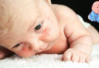 Bebeklerde İsilik: Nedenleri, Belirtileri ve Tedavi Yöntemleri