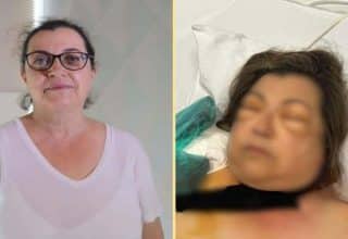 İzmir’de Nadir Bir Tıbbi Vaka: Yıldız Öziş’in Hayat Mücadelesi