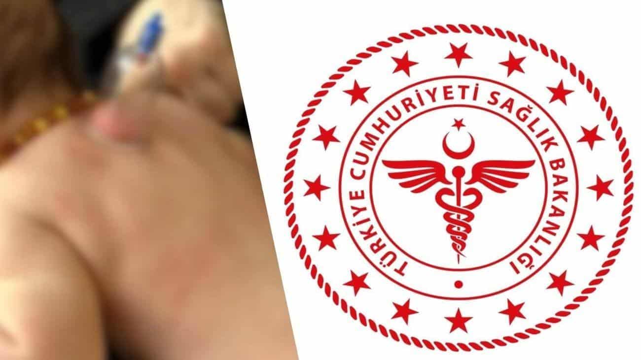 yeni dogan bebeklere hacamat uygulamasi uzerine sorusturma nBz6URAR