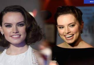 Daisy Ridley’nin Graves Hastalığı Açıklaması