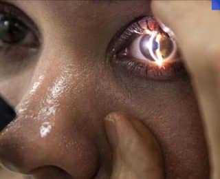 Göz Sağlığını Korumanın Yolları ve Önerilen Besinler