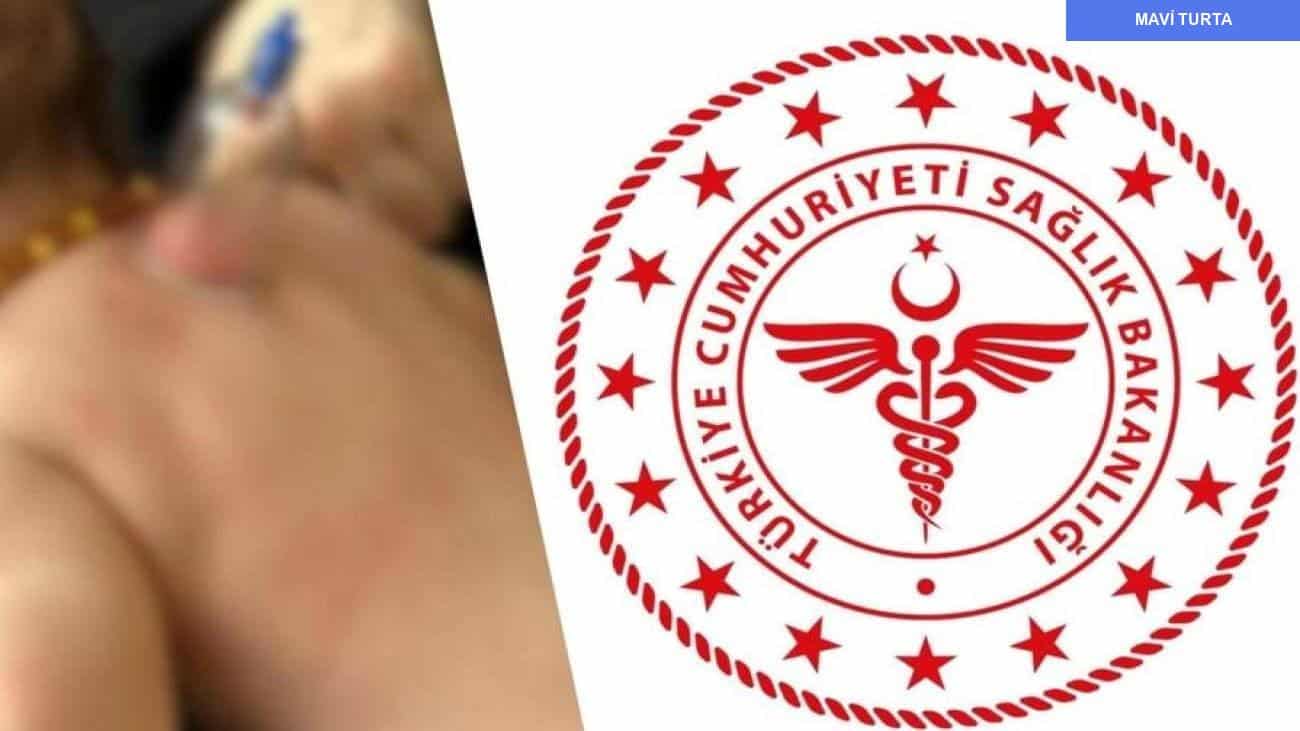 yenidogan bebeklere hacamat uygulamasi uzerine bilimsel uyarilar 3uYVXfOM