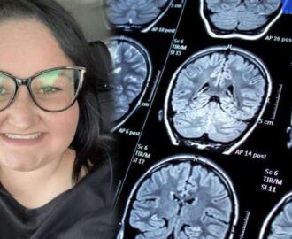 Baş ağrısıyla doktora gitti, hayatının şokunu yaşadı: 18 aylık ömrün kaldı